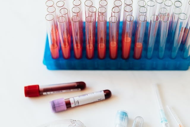 Análisis de Hierro en Sangre: Preguntas Frecuentes